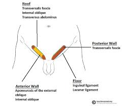 Inguinal and femoral hernias are the most common conditions for which primary care physicians refer patients for surgical management. The Inguinal Canal Boundaries Contents Teachmeanatomy