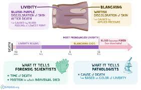 We did not find results for: Lividity What Is It Forensic Application Pathological Implications And More Osmosis