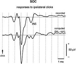 The use of metal detectors to locate gold nuggets is something that's relatively new. Origin Of The Binaural Interaction Component In Wave P4 Of The Short Latency Auditory Evoked Potentials In The Cat Evaluation Of Serial Depth Recordings From The Brainstem Sciencedirect