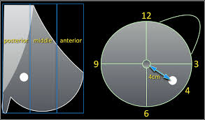 Maybe you would like to learn more about one of these? The Radiology Assistant Bi Rads For Mammography And Ultrasound 2013