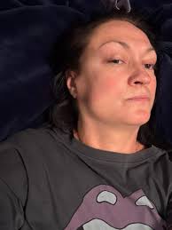 What is your osteoarthritis story?