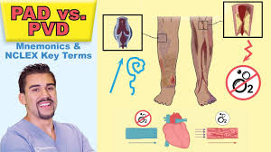 peripheral arterial disease top tested signs symptoms for peripheral vascular pad vs pvd memo