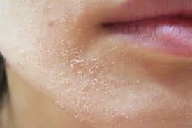 #wajah terasa kering kebiasaan mencuci wajah lebih dari dua kali dalam sehari harus segera dihentikan jika tidak ingin wajah terasa kering dan kesat. Wajah Kering Bukan Halangan Untuk Tampil Cantik Coba Saja 10 Pilihan Bedak Dan Kosmetik Untuk Kulit Kering Dari Bp Guide Ini