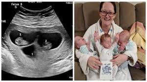 Les fausses couches spontanées et les morts fœtales in utero avant 24 semaines affectent une grossesse sur cinq. Elle Pensait Faire Une Fausse Couche Et Decouvre Qu Elle Est Enceinte De Triples