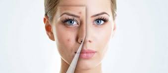 Kitchen Ingredients To Help You With Skin Problems! · Balancing BRCA