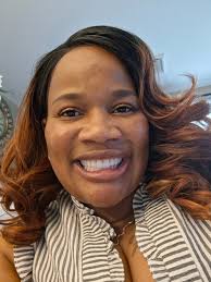 Bionic smile dental results after 4 days