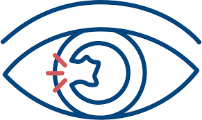 Image result for Cornea