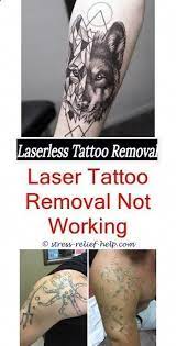 Tattoo Paper How To Know If Tattoo Removal Is Infected Is Picosure The Best Tattoo Removal Tattoo Needles Tatt Tattooentfernung Tattoo Verblasst Beste Tattoo