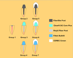 Standardized acrylic resin roots (n = 40) with prefabricated fiber posts (relyx™ fiber post 3d) were split into four sets (n = 10) based on many types of cementation materials and techniques. Fracture Strength Of Endodontically Treated Teeth Restored With Different Fiber Post And Core Systems Springerlink