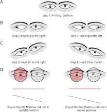 Image result for Diplopia