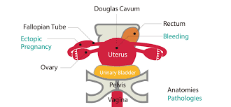 Ultrasound of the pelvis protocol. Female Pelvic Ultrasound Phantom Kyoto Kagaku