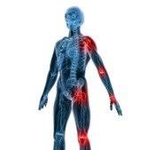 Ce dernier est un tissu de protéines qui recouvre les os et dont la surface est tapissée de liquide synovial. Arthrose Reviews Facebook