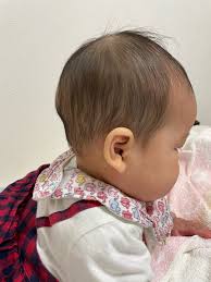 赤ちゃん 頭 の 形 きれい