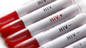 Itu sebabnya penting untuk mengetahui dengan benar cara penularan hiv, sehingga anda tidak tertula penyakit ini. Cara Pencegahan Hiv Sejak Dini Serta Gejala Yang Sering Tak Disadari Health Liputan6 Com