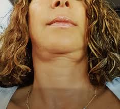 Holly L. Barbour, MD, Physician