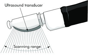 Diagnosis was made on the tbnaslides and cell block/biopsy material. Scheme Of The Tip Of The Ebus Tbna Bronchoscope Download Scientific Diagram