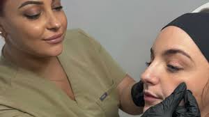 Best Laser Skin Resurfacing near me in Nuneaton