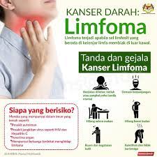 Gejala dan tanda menghidap kanser ovari. Sabahfm Kanser Darah Atau Limfoma Tanda Dan Gejala Facebook