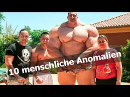 Listen to anomalien | soundcloud is an audio platform that lets you listen to what you love and share the 19 followers. 10 Menschliche Anomalien Menschen Mit Riesigen Korperteilen Youtube