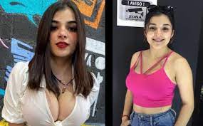 Karely Ruiz: antes y después de sus cirugías estéticas 