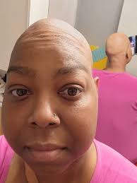 Fundraiser by Monique Pugh : Monique's Battle With Multiple Myeloma Cancer