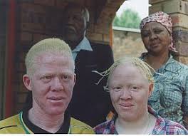 Image result for causes of albinism