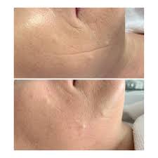 Check spelling or type a new query. Kosmetikstudio Beauty Mosaic In Frankfurt Hifu