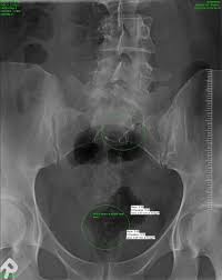 Pin On Health