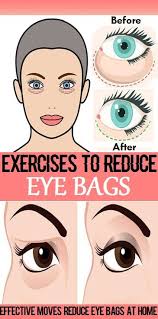 Effective Exercises To Reduce Eye Bags At Home Http Bestantiagingsecrets Net Know Face Wrinkle Anti Aging Help Can Sto Face Wrinkles Face Exercises Face Yoga