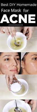 This Diy Homemade Acne Face Mask Scrub Is An Excellent Natural Remedy For Getting Rid Of Acne It S The Perf Acne Face Mask Homemade Face Acne Acne Face Mask