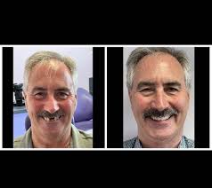 THE VB• 'Dr Dee, Here's a picture of my new smile! Thank you so much' One  of patients from Manchester who we have treated with complete replacement  dentures. That's right she has