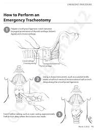 Emergency Tracheotomy Would You Do It Neogaf Emergency Medicine Emergency Medical Education