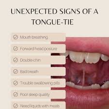 Signs of a tongue-tie don't always point to there being a tongue-tie. If you  have any suspicions based on your signs and symptoms, reach out! With a  comprehensive evaluation we can figure