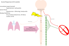 Cardiac Electrophysiology Of Patients With Spinal Cord Injury Heart Rhythm