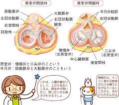 解剖 知恵 おしゃれまとめの人気アイデア pinterest 美奈緒 看護ノート 循環器系 循環器内科