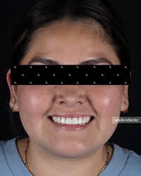 Hola!, mi nombre es Karla Esquer soy cirujano dentista egresada de la  Universidad Autónoma de Baja California, una de las cosas que mas me gusta  hacer de mi trabajo es realizar diseños