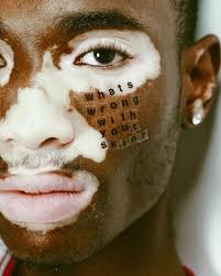 Pinterest Photography Beauty Standards Face