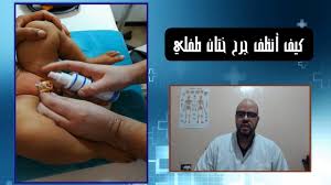 كيف اقوم بتنظيف جرح ختان طفلي Youtube