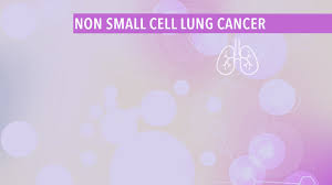 Various factors can cause this mutation to happen. Understand Alk Inhibitor Treatment Of Alk Positive Lung Cancer Cancerconnect