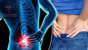 Adriana sarah nica, medic specialist în balneologie, medicină fizică și recuperare medicală. Tratamente Naturiste Buruiana Din ÈanÈuri Care VindecÄ Spondiloza CervicalÄ Osteocondroza Este Un Remediu Eficient