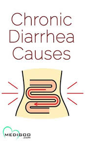 Chronic Diarrhea Diarrhea Causes Diarrhea Acute Diarrhea