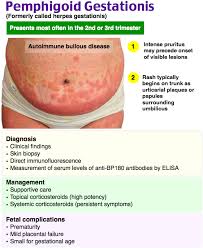 Image result for pruritic urticarial papules and plaques of pregnancy