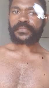 West Papuans say they're being targeted by violent militia