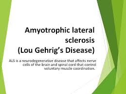 Pathophysiology, evaluation, and effect of weight loss: Amyotrophic Lateral Sclerosis Lou Gehrig S Disease Ppt Video Online Download