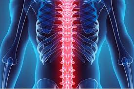 Image result for Intrathecal Pump