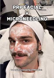 Revitalize Your Skin with PRP Therapy