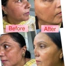 129 Photos of Dr Tanreet's Skin Hair & Laser Center in Amritsar Colony,  Amritsar