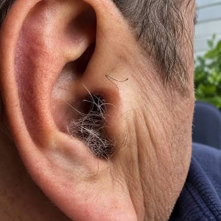 DID YOU KNOW? If you have hair growing on your ears, it's due to your body!  awesome... ready....
