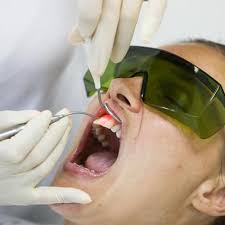 Gummy Smile Treatment In South Delhi India Dr Kathuria S Dentistry