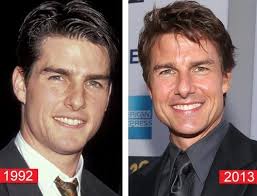 Tom Cruise Plastic Surgery Before After Plastic Surgery Plastic Surgery Photos Cosmetic Surgery